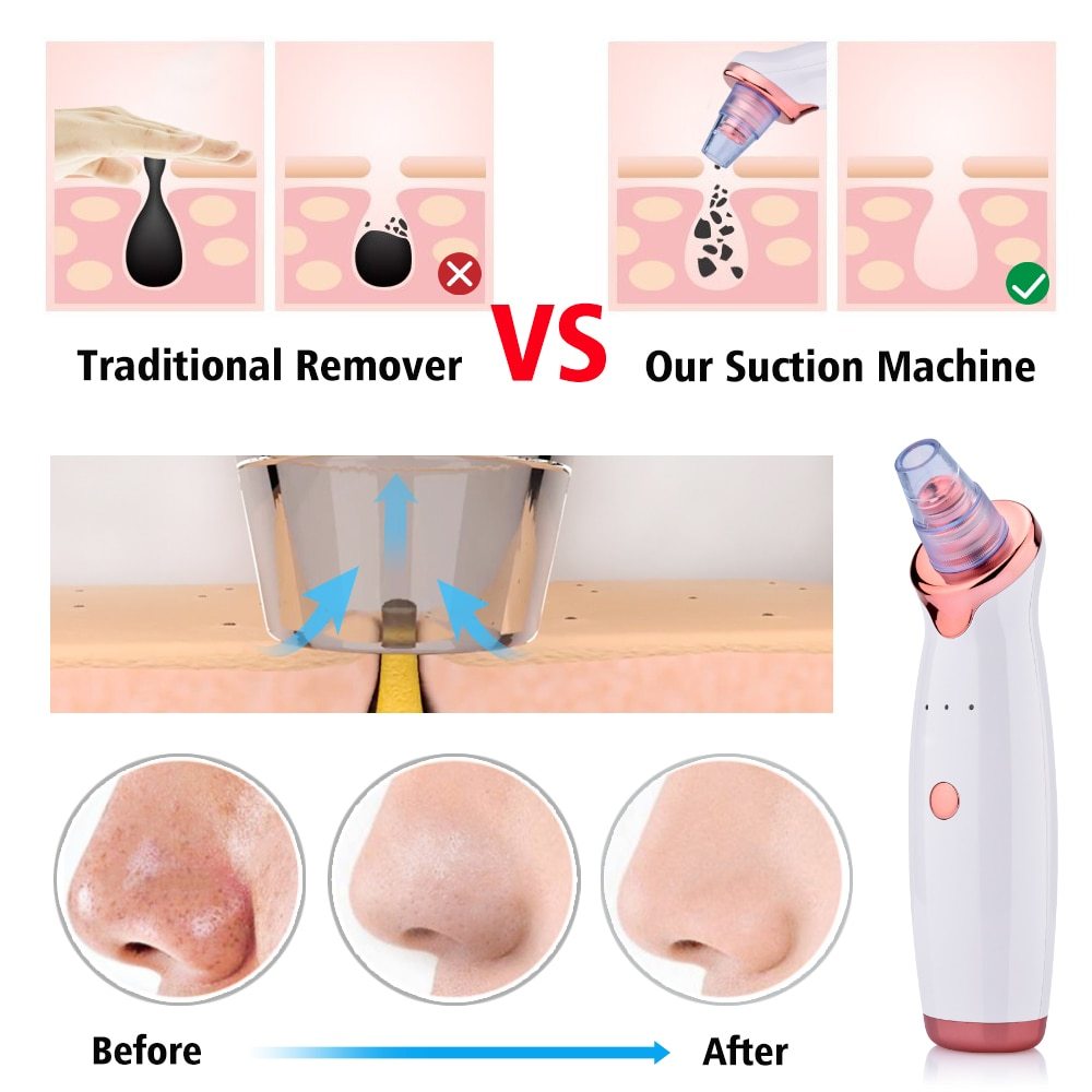 Blackhead Instrument Electric Suction Facial Washing Instrument