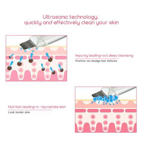 Ultrasonic Skin Scrubber Face Cleanser Blackhead Acne Removal Facial